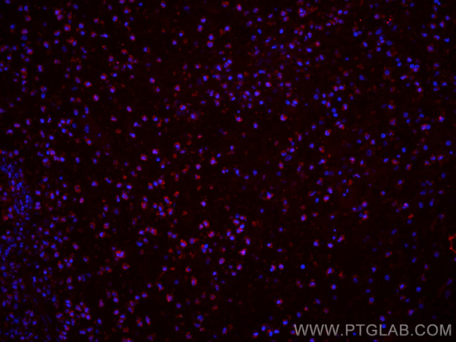 BCL2 Antibody in Immunohistochemistry (PFA fixed) (IHC (PFA))