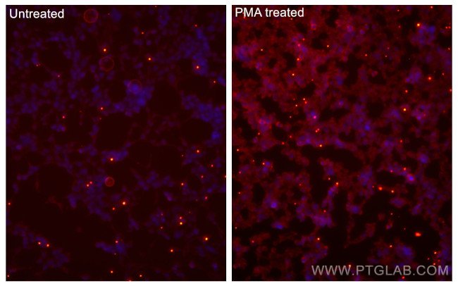 Phospho-mTOR (Ser2448) Antibody in Immunocytochemistry (ICC/IF)