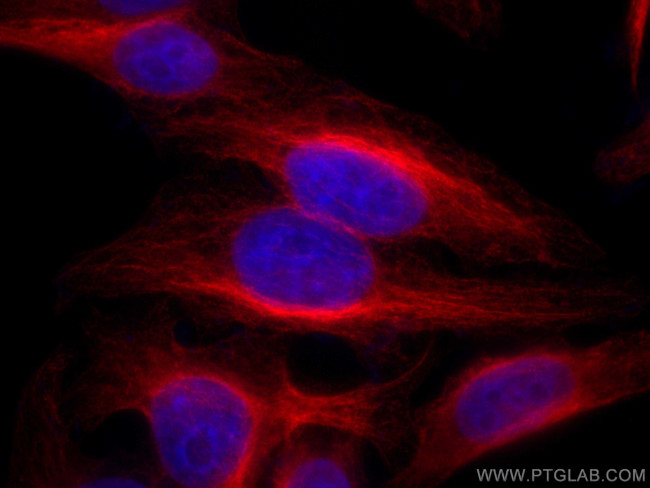 Alpha Tubulin Antibody in Immunocytochemistry (ICC/IF)