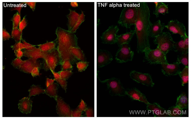 NF-kB p65 Antibody in Immunocytochemistry (ICC/IF)