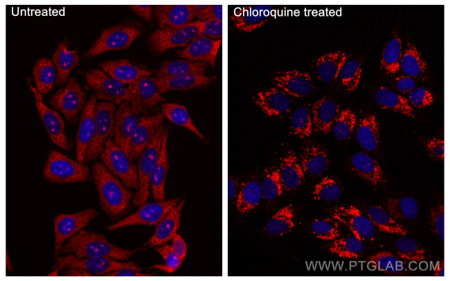 LC3 Antibody in Immunocytochemistry (ICC/IF)
