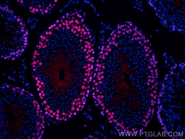 PCNA Antibody in Immunohistochemistry (Paraffin) (IHC (P))