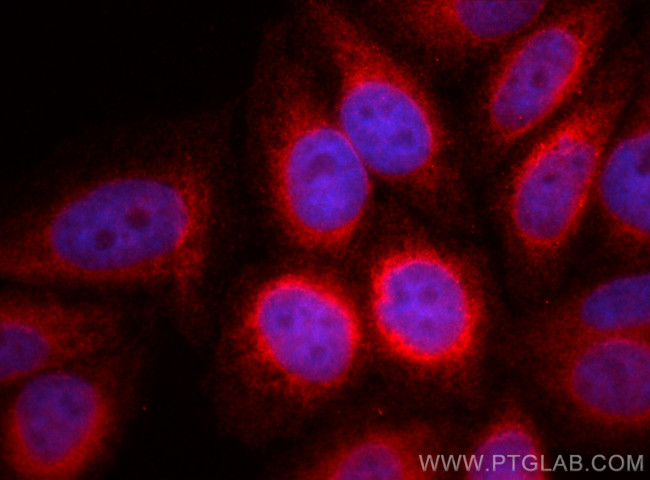 Calnexin Antibody in Immunocytochemistry (ICC/IF)