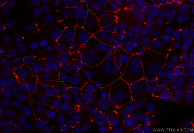 ZO-1 Antibody in Immunocytochemistry (ICC/IF)