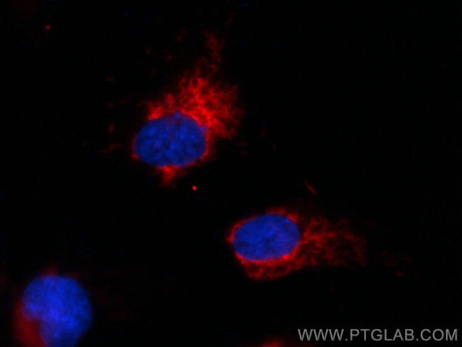SOD2 Antibody in Immunocytochemistry (ICC/IF)