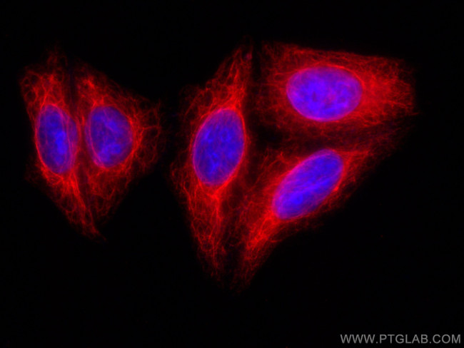 Cytokeratin 14 Antibody in Immunocytochemistry (ICC/IF)