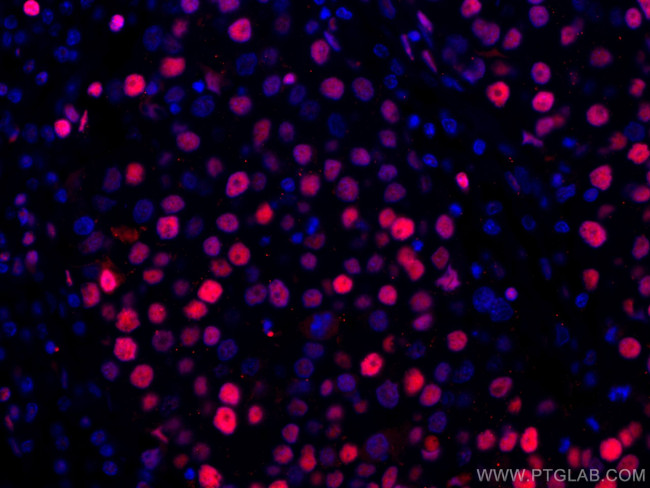 PCNA Antibody in Immunohistochemistry (Paraffin) (IHC (P))