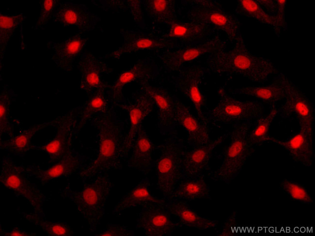PAX8 Antibody in Immunocytochemistry (ICC/IF)