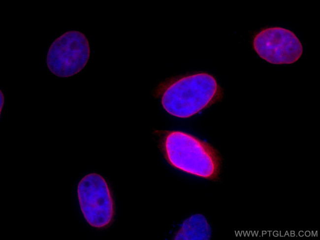 Emerin Antibody in Immunocytochemistry (ICC/IF)