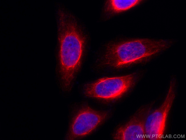 Vimentin Antibody in Immunocytochemistry (ICC/IF)