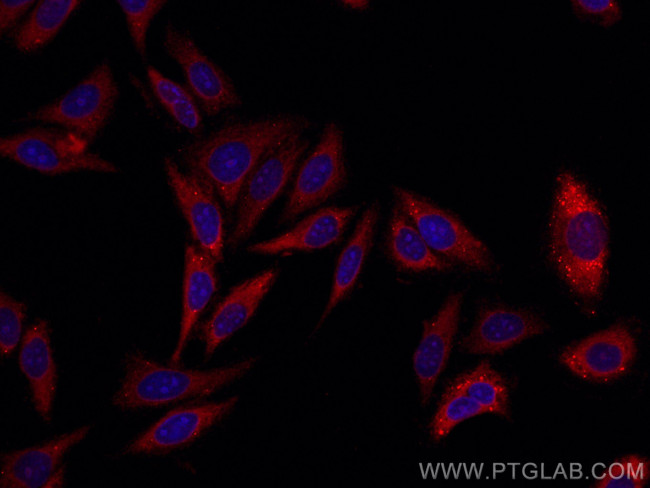 MOV10 Antibody in Immunocytochemistry (ICC/IF)