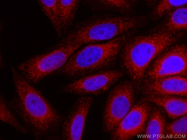 Calnexin Antibody in Immunocytochemistry (ICC/IF)