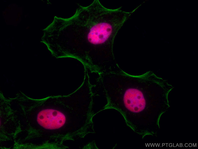 P53 Antibody in Immunocytochemistry (ICC/IF)