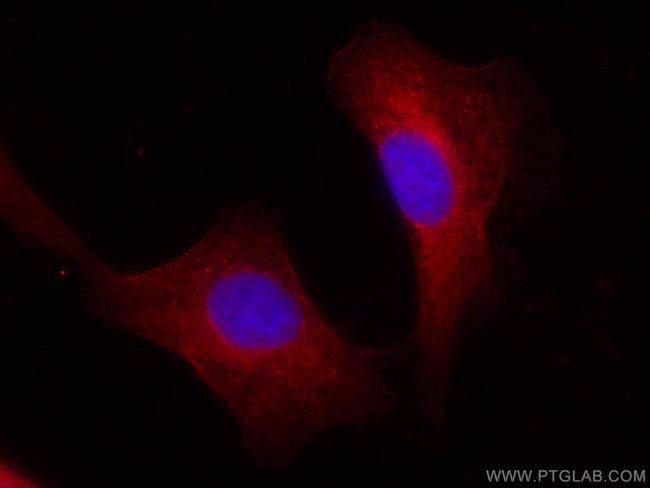 BAG3 Antibody in Immunocytochemistry (ICC/IF)
