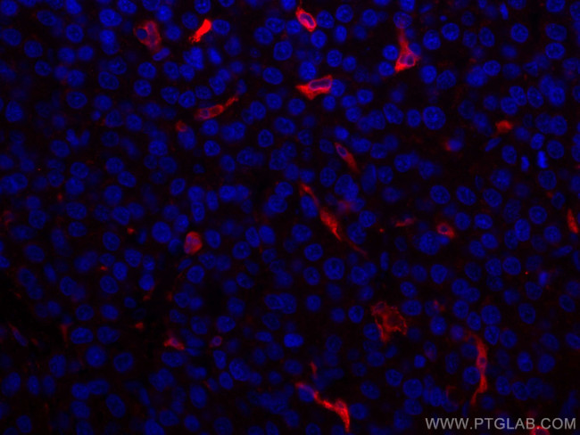 HO-1/HMOX1 Antibody in Immunohistochemistry (Paraffin) (IHC (P))