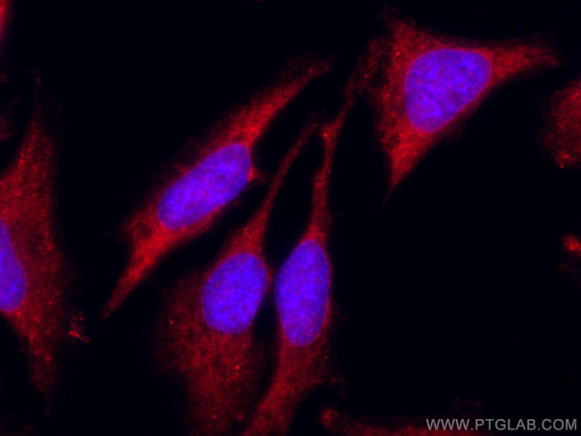 Sestrin 2 Antibody in Immunocytochemistry (ICC/IF)