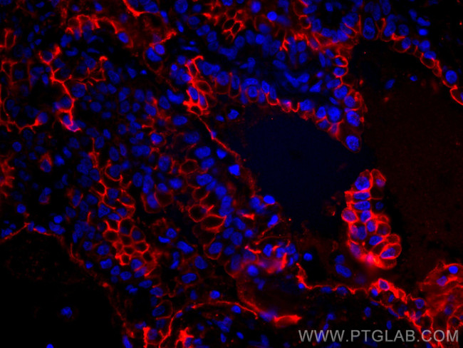 ICAM-1 Antibody in Immunohistochemistry (Paraffin) (IHC (P))