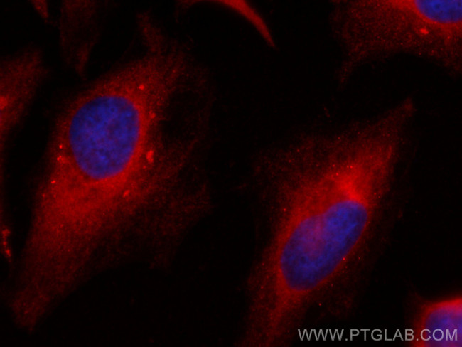 CYB5R3 Antibody in Immunocytochemistry (ICC/IF)