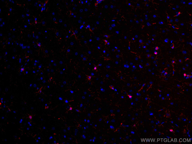 IBA1 Antibody in Immunohistochemistry (Paraffin) (IHC (P))
