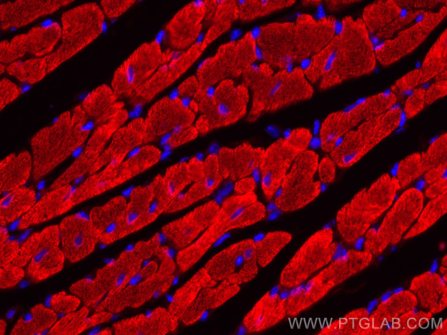 Myosin Light Chain 2/MLC-2V Antibody in Immunohistochemistry (Paraffin) (IHC (P))