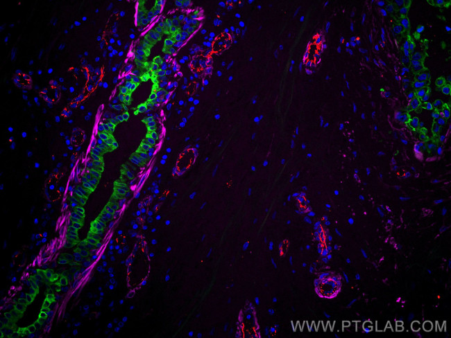 CD31 Antibody in Immunohistochemistry (Paraffin) (IHC (P))