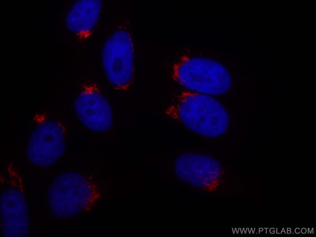 GOLGA2/GM130 Antibody in Immunocytochemistry (ICC/IF)