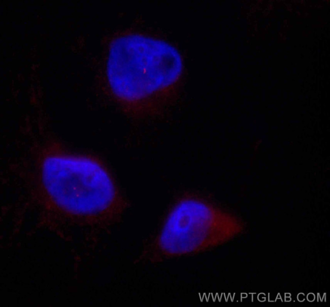 CENPJ Antibody in Immunocytochemistry (ICC/IF)