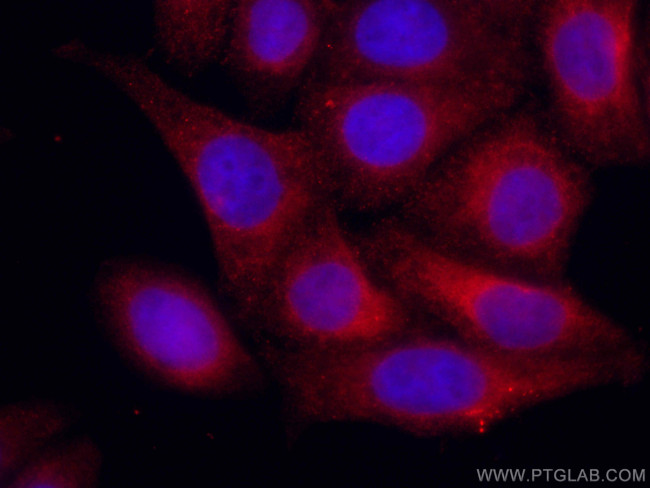 GRP78/BIP Antibody in Immunocytochemistry (ICC/IF)