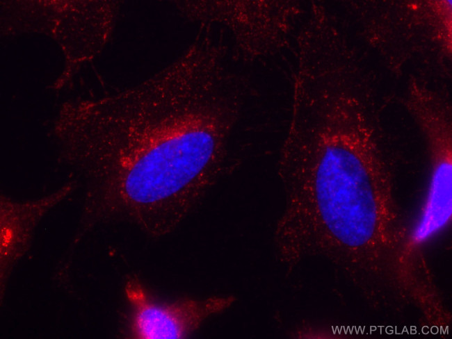 IFITM3 Antibody in Immunocytochemistry (ICC/IF)