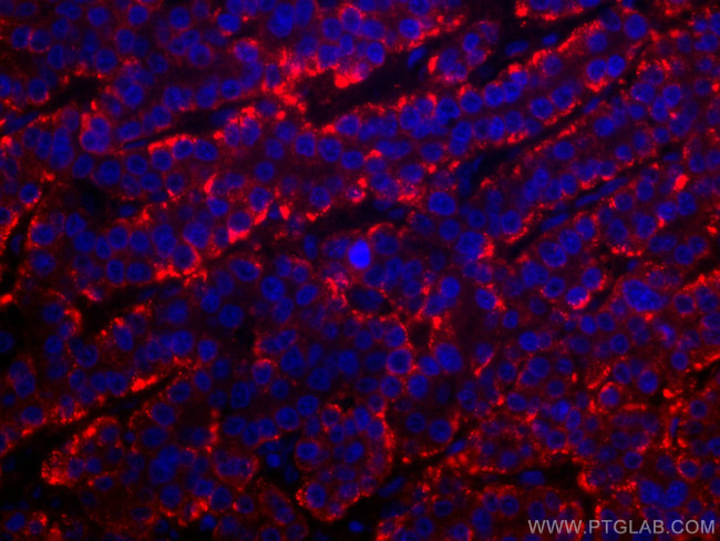 ASGR1 Antibody in Immunohistochemistry (Paraffin) (IHC (P))