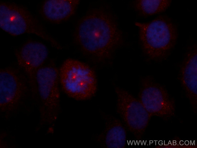 CSPP1 Antibody in Immunocytochemistry (ICC/IF)