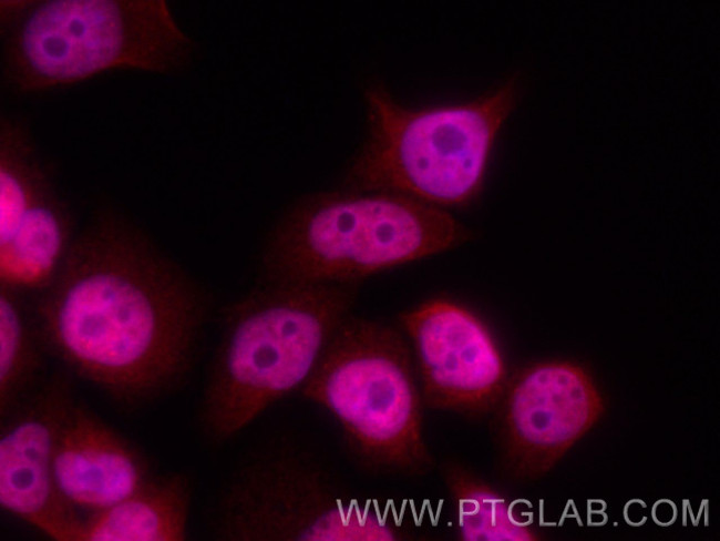 TIA1 Antibody in Immunocytochemistry (ICC/IF)