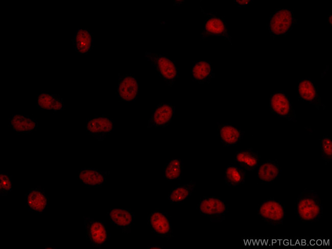 CREB1 Antibody in Immunocytochemistry (ICC/IF)