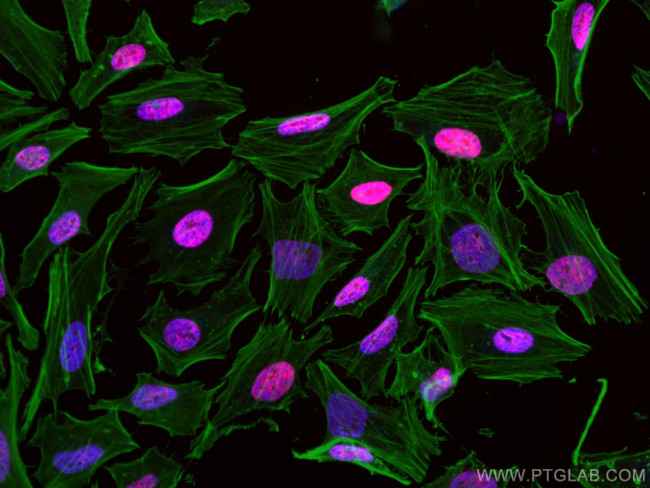 CREST Antibody in Immunocytochemistry (ICC/IF)