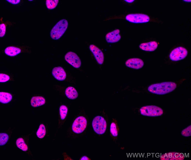 TDP-43 Antibody in Immunocytochemistry (ICC/IF)