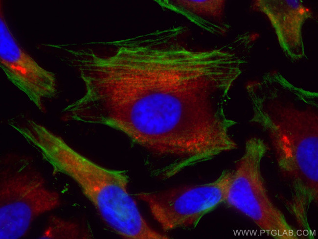 IMPDH2 Antibody in Immunocytochemistry (ICC/IF)