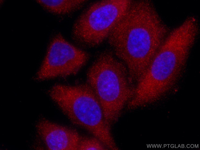 TFEB Antibody in Immunocytochemistry (ICC/IF)