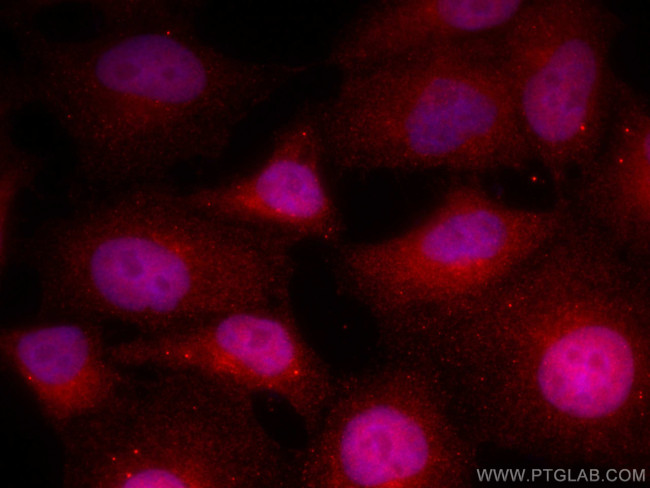PFKFB3 Antibody in Immunocytochemistry (ICC/IF)