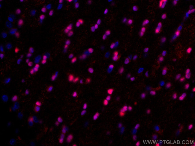 OLIG2 Antibody in Immunohistochemistry (Paraffin) (IHC (P))
