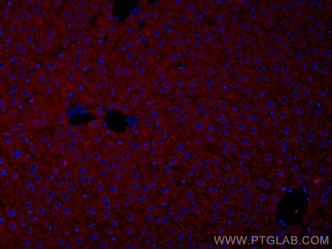 Apolipoprotein AI Antibody in Immunohistochemistry (Paraffin) (IHC (P))