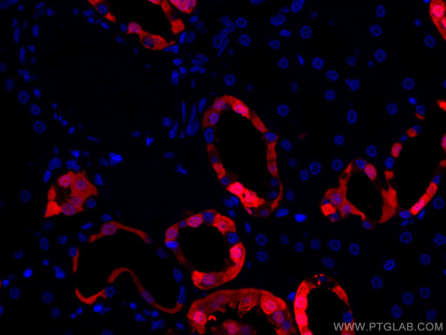 Calbindin-D28k Antibody in Immunohistochemistry (Paraffin) (IHC (P))