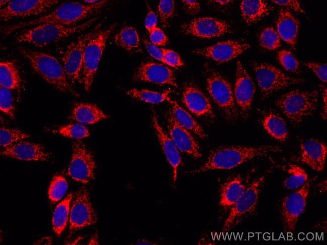 TOM70 Antibody in Immunocytochemistry (ICC/IF)