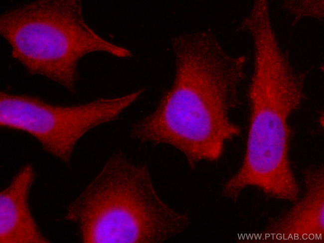 UBXD1 Antibody in Immunocytochemistry (ICC/IF)