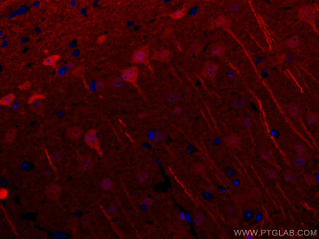 UCHL1/PGP9.5 Antibody in Immunohistochemistry (Paraffin) (IHC (P))