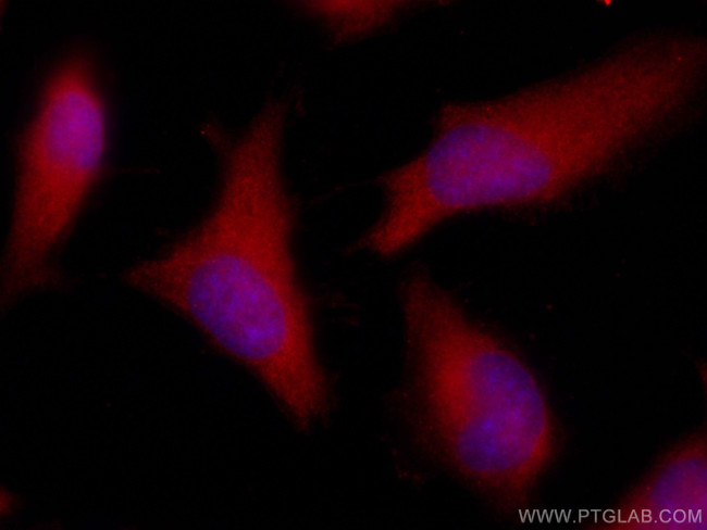 Galectin-3 Antibody in Immunocytochemistry (ICC/IF)