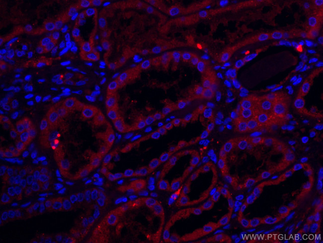 TCTN1 Antibody in Immunohistochemistry (Paraffin) (IHC (P))