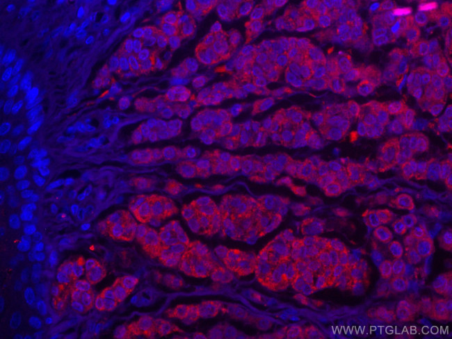 S100 Beta Antibody in Immunohistochemistry (Paraffin) (IHC (P))