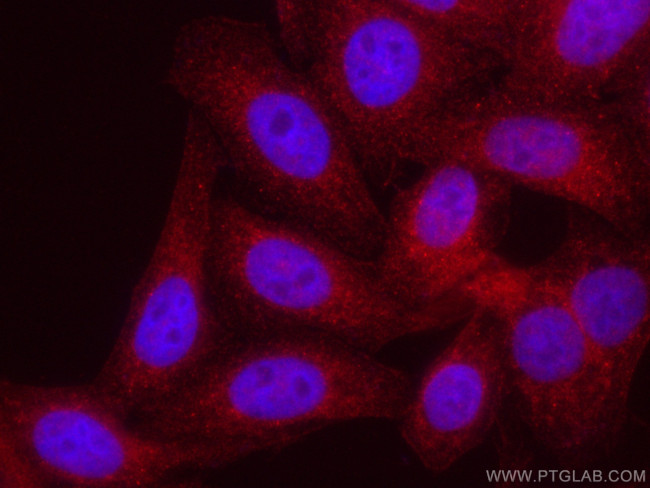 RBPMS Antibody in Immunocytochemistry (ICC/IF)