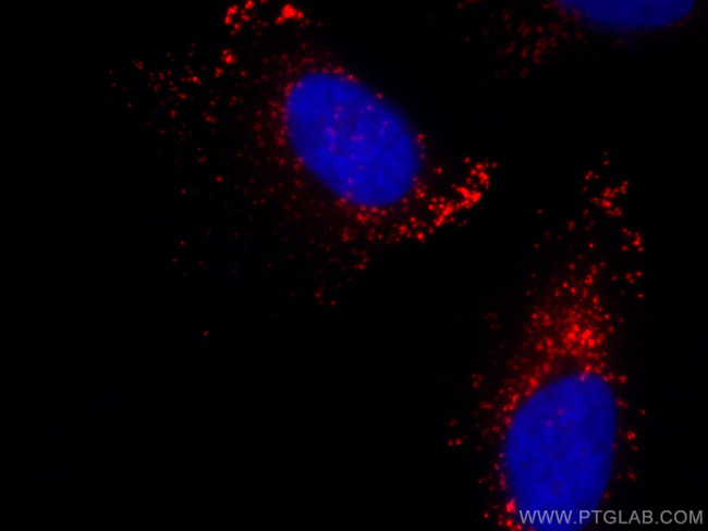 ADRP/Perilipin 2 Antibody in Immunocytochemistry (ICC/IF)