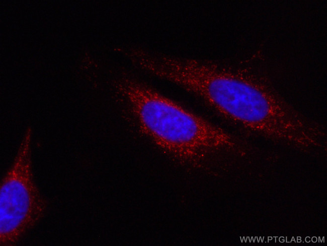 LONP1 Antibody in Immunocytochemistry (ICC/IF)